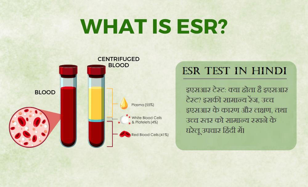 ESR Test in Hindi-अर्थ, नॉर्मल रेंज, हाई ESR के कारण, लक्षण व घरेलू उपचार