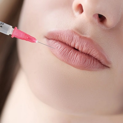 How Much Do Lip Fillers Typically Cost? - Estheticare
