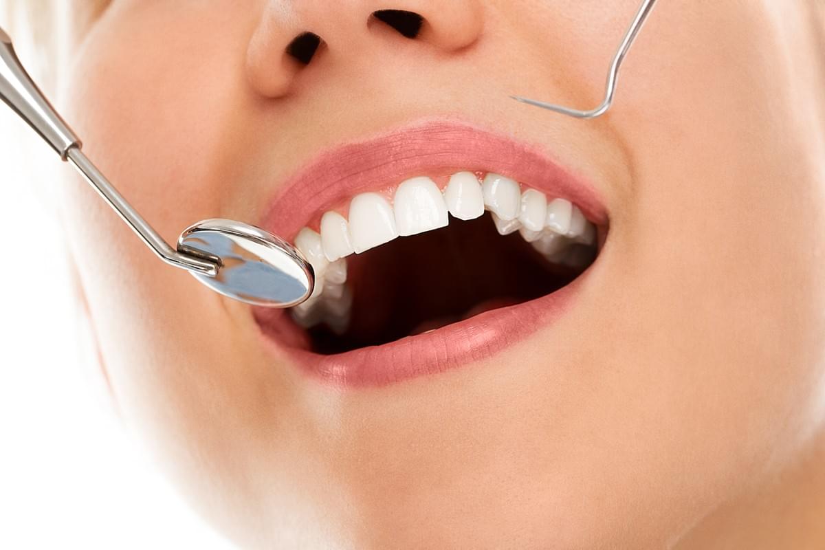 Transform Your Smile with Dental Implants Solihull, Cle...