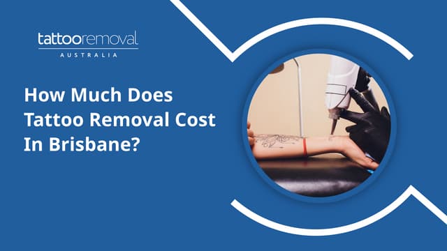 How Much Does Tattoo Removal Cost In Brisbane? | PPT