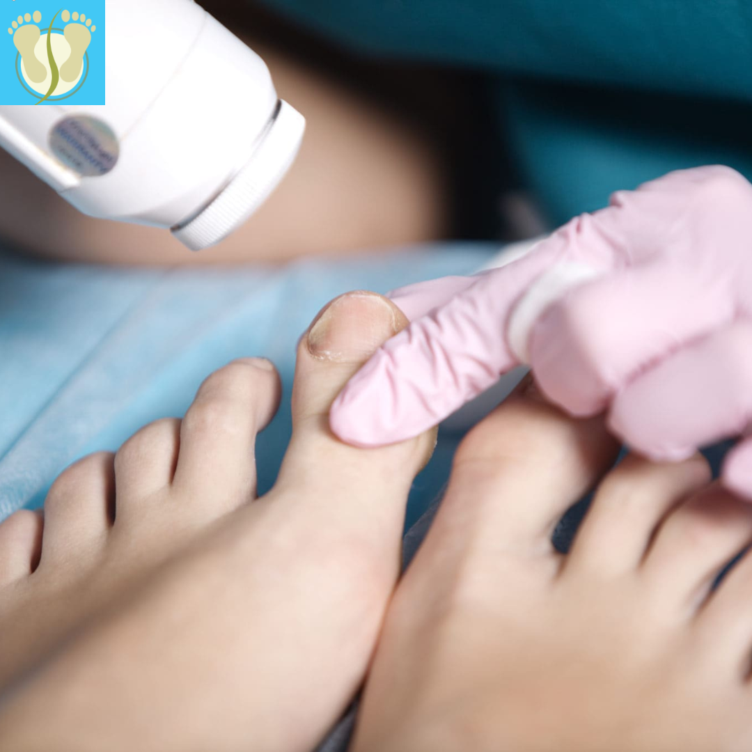 Dry Needling & Crawled Toes Treatment in Townsville | Ian’s Podiatry – Ians Podiatry