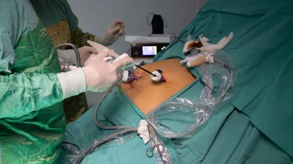 Revisional Weight Loss Surgery