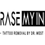 Erase My Ink Profile Picture