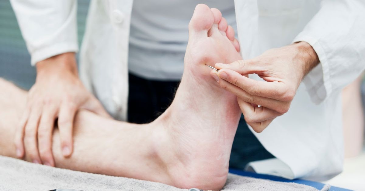 A Complete Guide to Hammertoe Surgery, Foot Arthritis Care, and Foot & Ankle Fracture Treatment