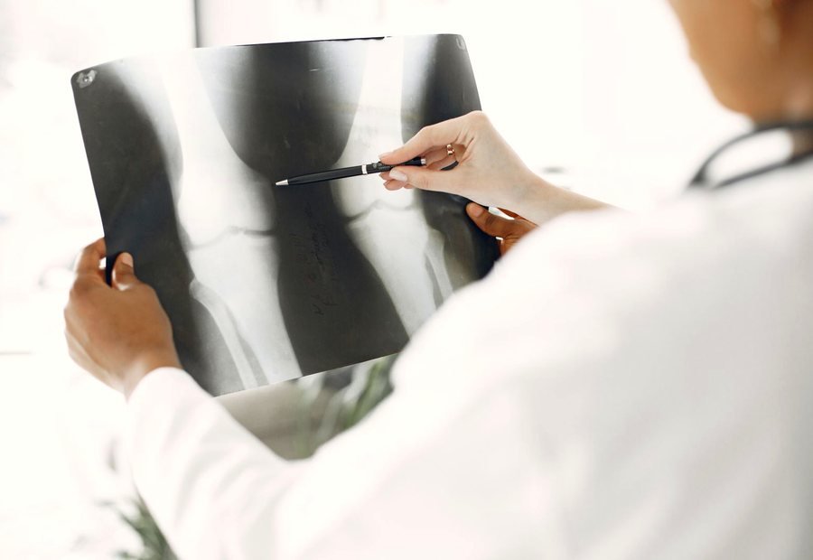 Knee Replacement Surgery