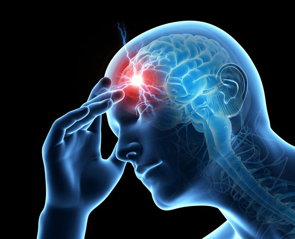 The Best Marijuana Strains for Migraines - Rethink-Rx