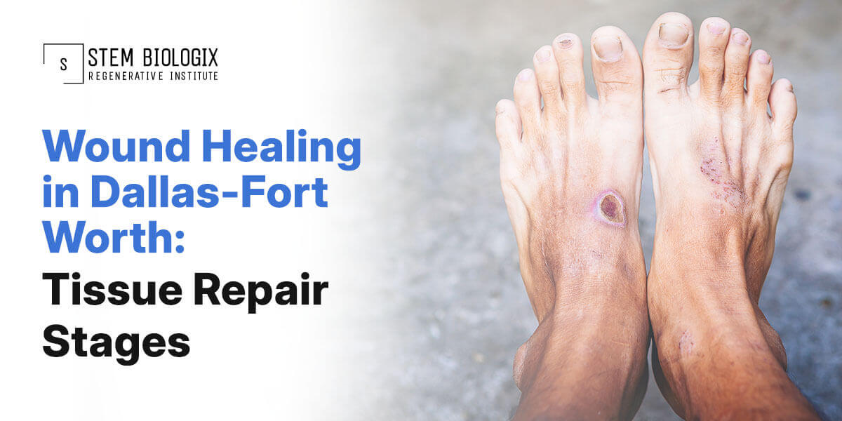 Wound healing in Dallas–Fort Worth | Stem Biologix
