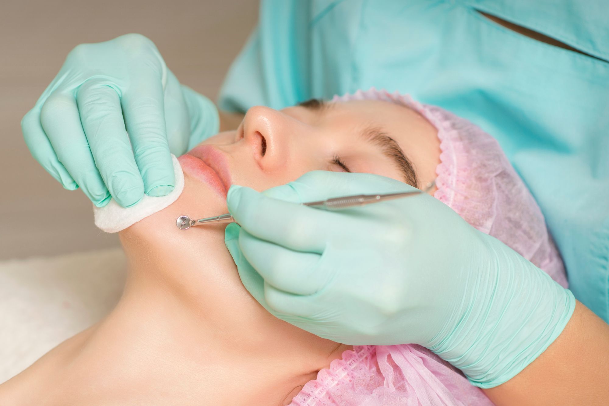 Best Acne Spot Treatment Price Malaysia - Clear Skin Starts Here