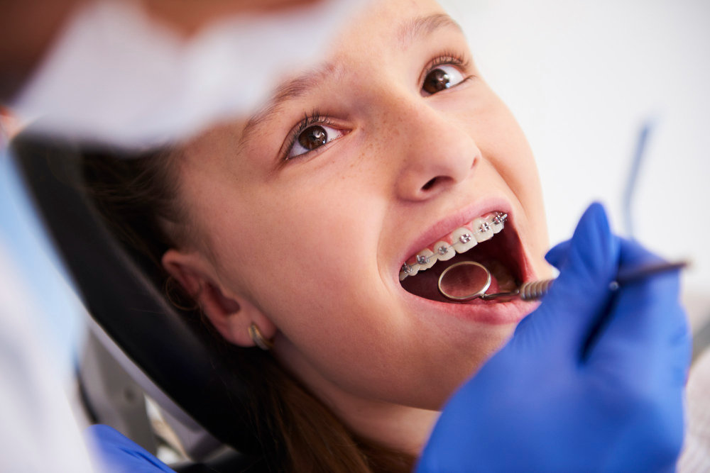 Can Braces Cost Less If You Choose an Orthodontist in Edmonton Early?