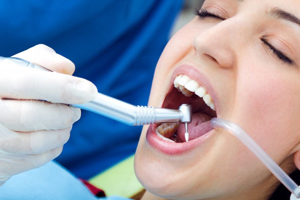 Sealants vs Fluoride Treatments: What's the Difference?