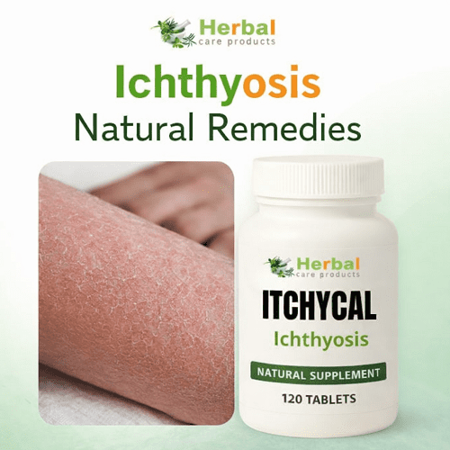New Treatments for Ichthyosis - Ichthyosis Natural Remedies