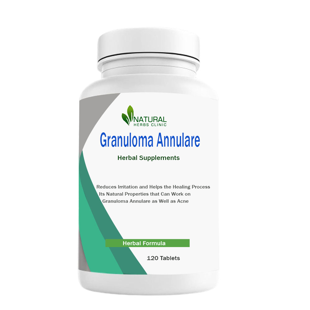 Best Treatment for Granuloma Annulare | Natural Herbs Clinic